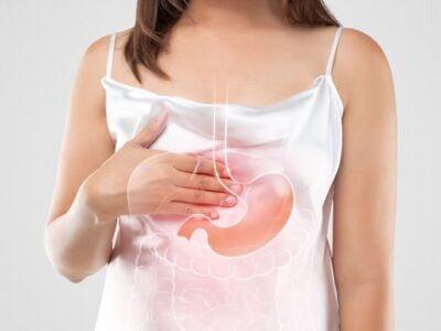 Bile Reflux After Mini Gastric Bypass Surgery